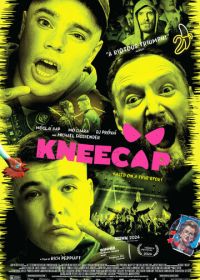 Никап (2024) Kneecap